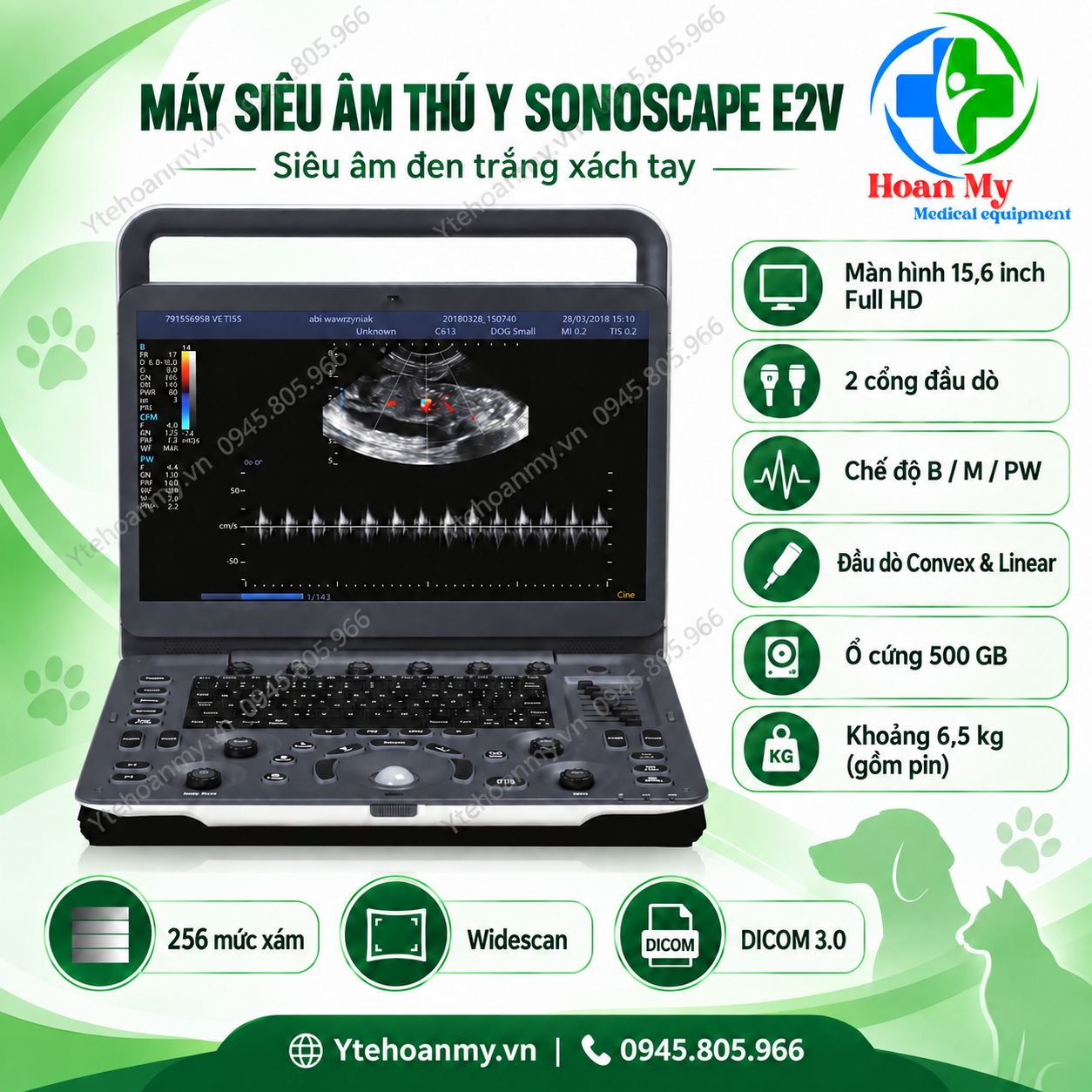 M&aacute;y si&ecirc;u &acirc;m th&uacute; y SonoScape E2V Doppler m&agrave;u - Giải ph&aacute;p chẩn đo&aacute;n chuy&ecirc;n nghiệp